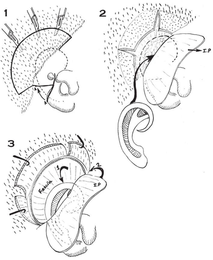 figura9b.jpg
